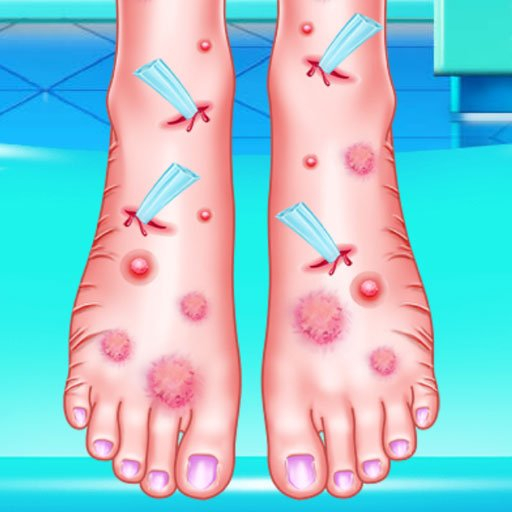 Игра Лечение Ног Эммы Игра Лечение Ног Эммы / Emma Foot Treatment